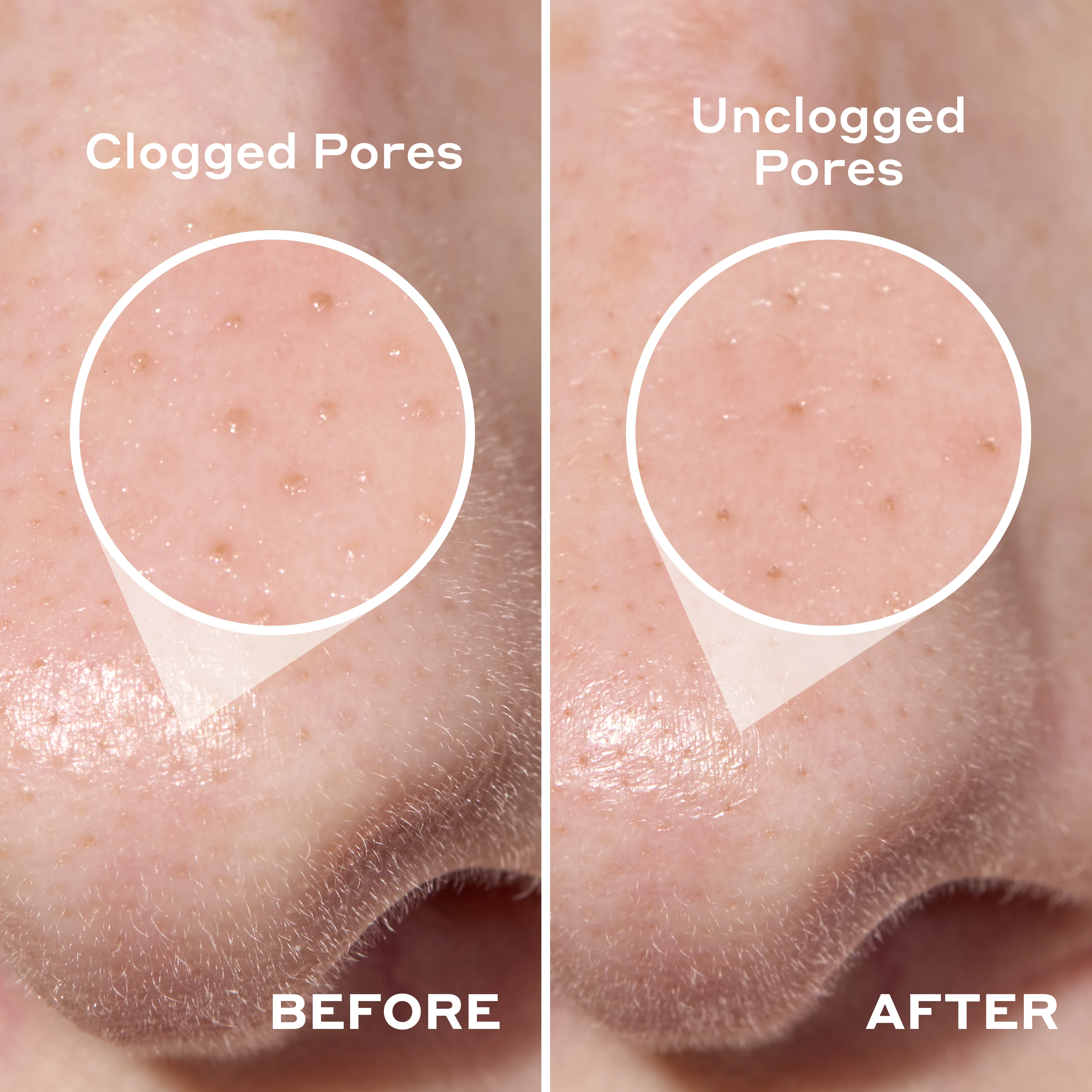 2-in-1 Deep Cleansing Pore Strip - Image 7