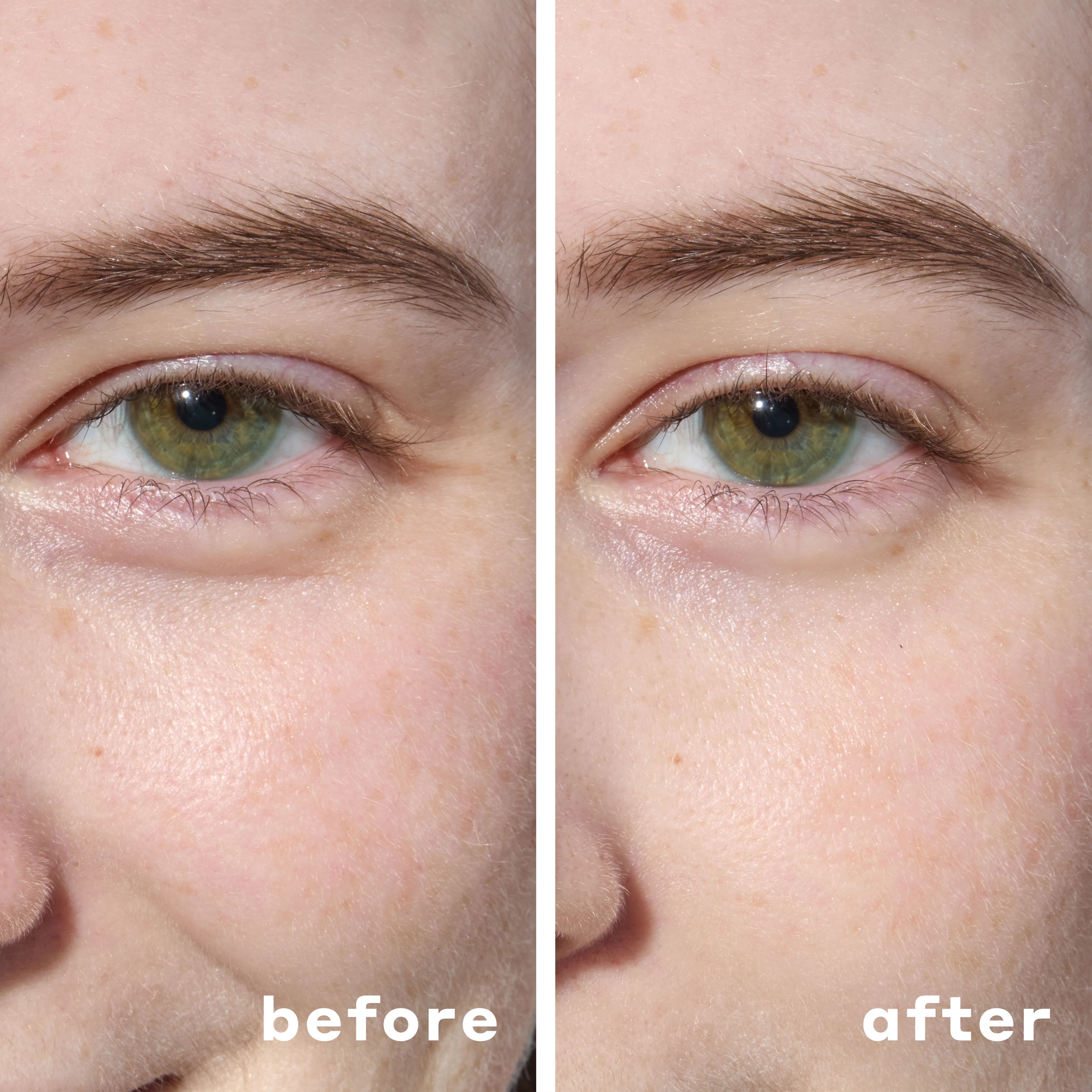 Hydrogel Under Eye Patches - Image 9