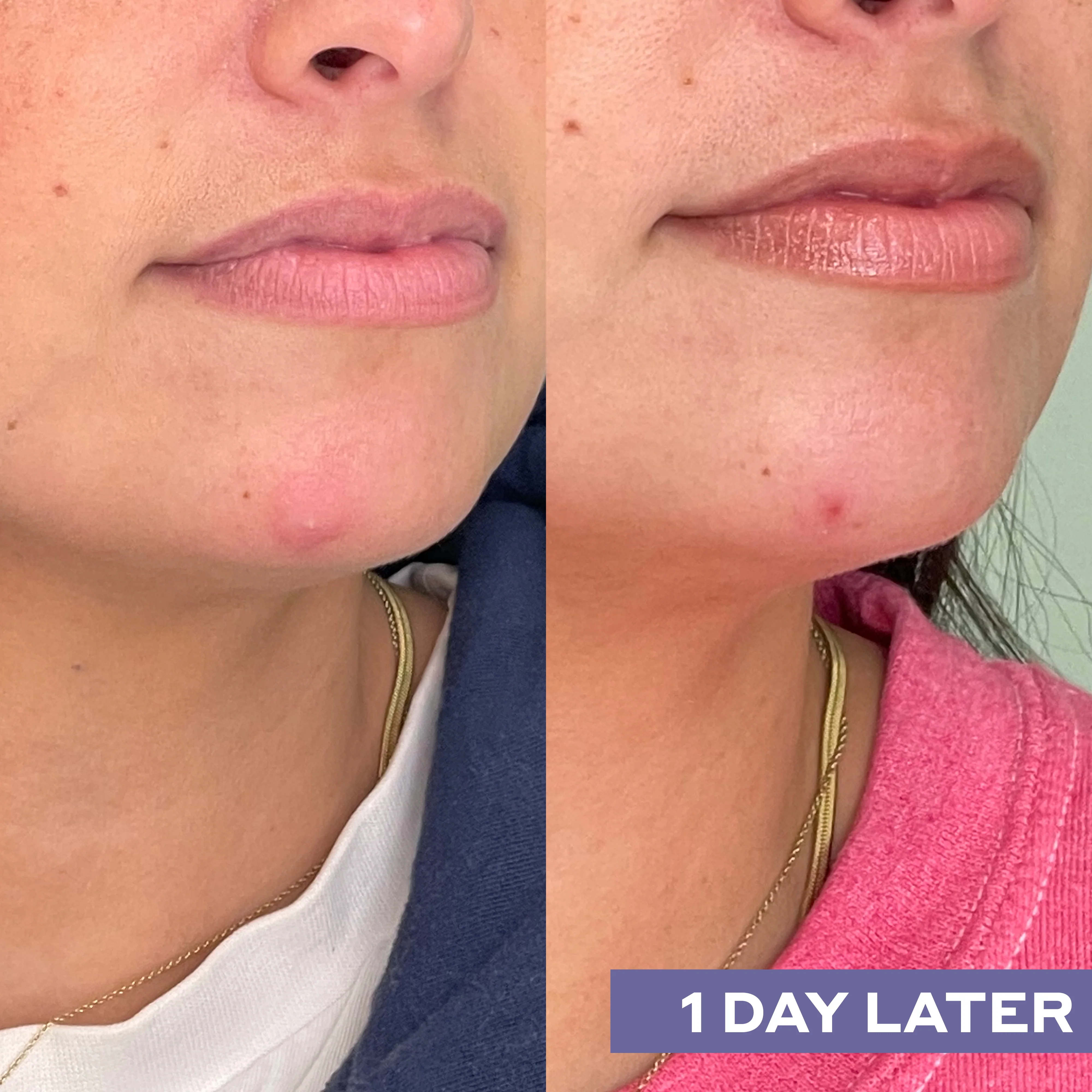 Repairing Facial Spray with Hypochlorous Acid - Image 7