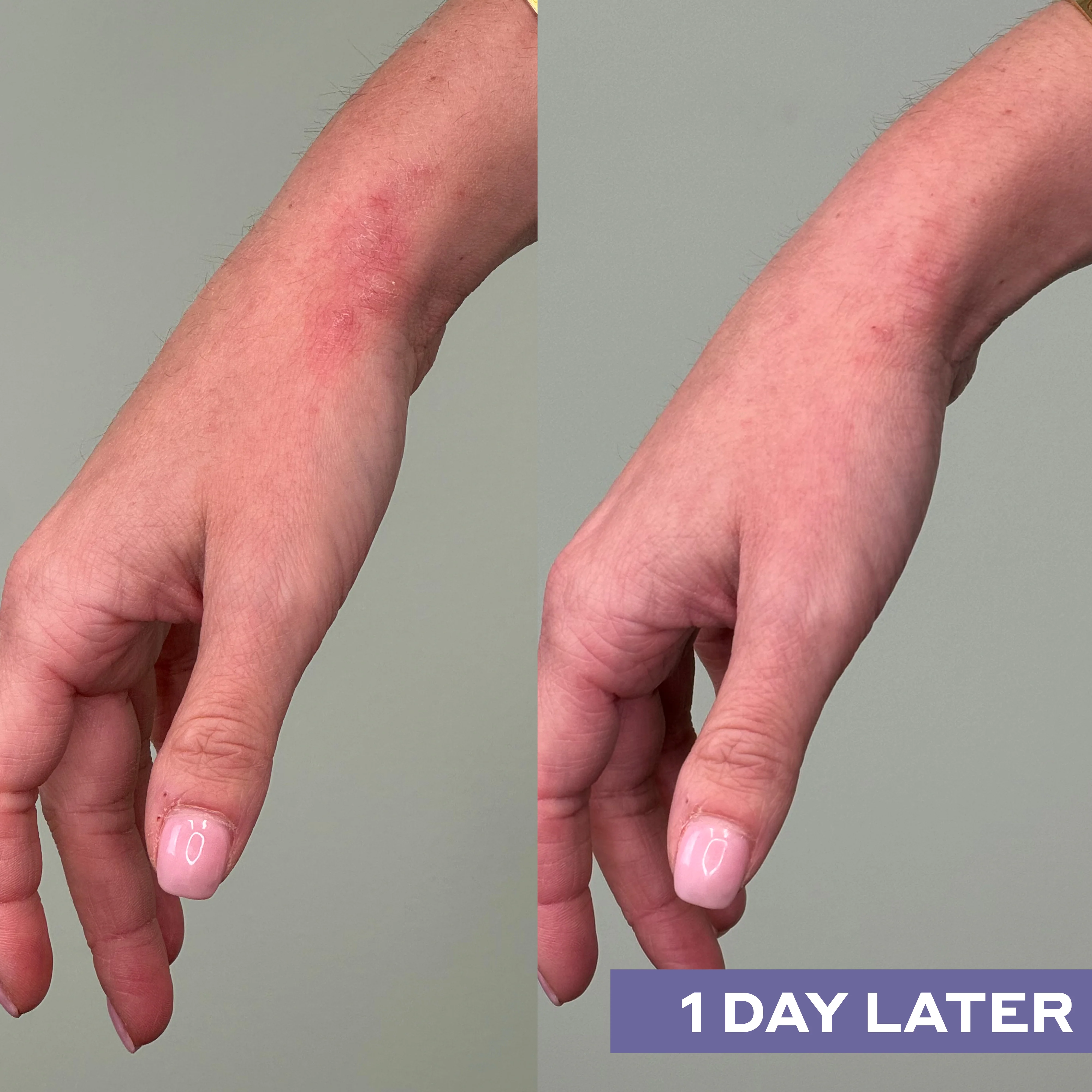 Repairing Facial Spray with Hypochlorous Acid - Image 8