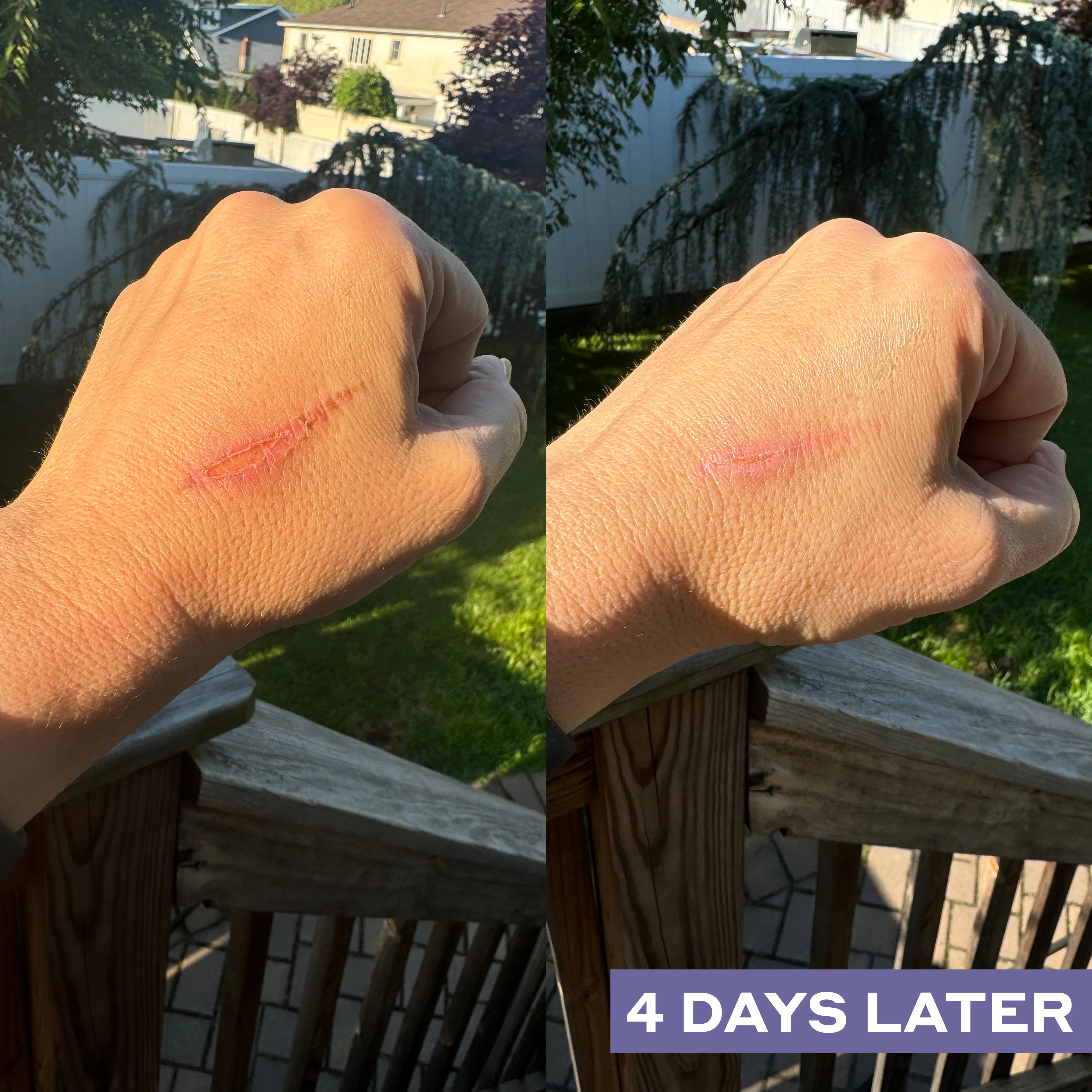 Repairing Facial Spray with Hypochlorous Acid - Image 9