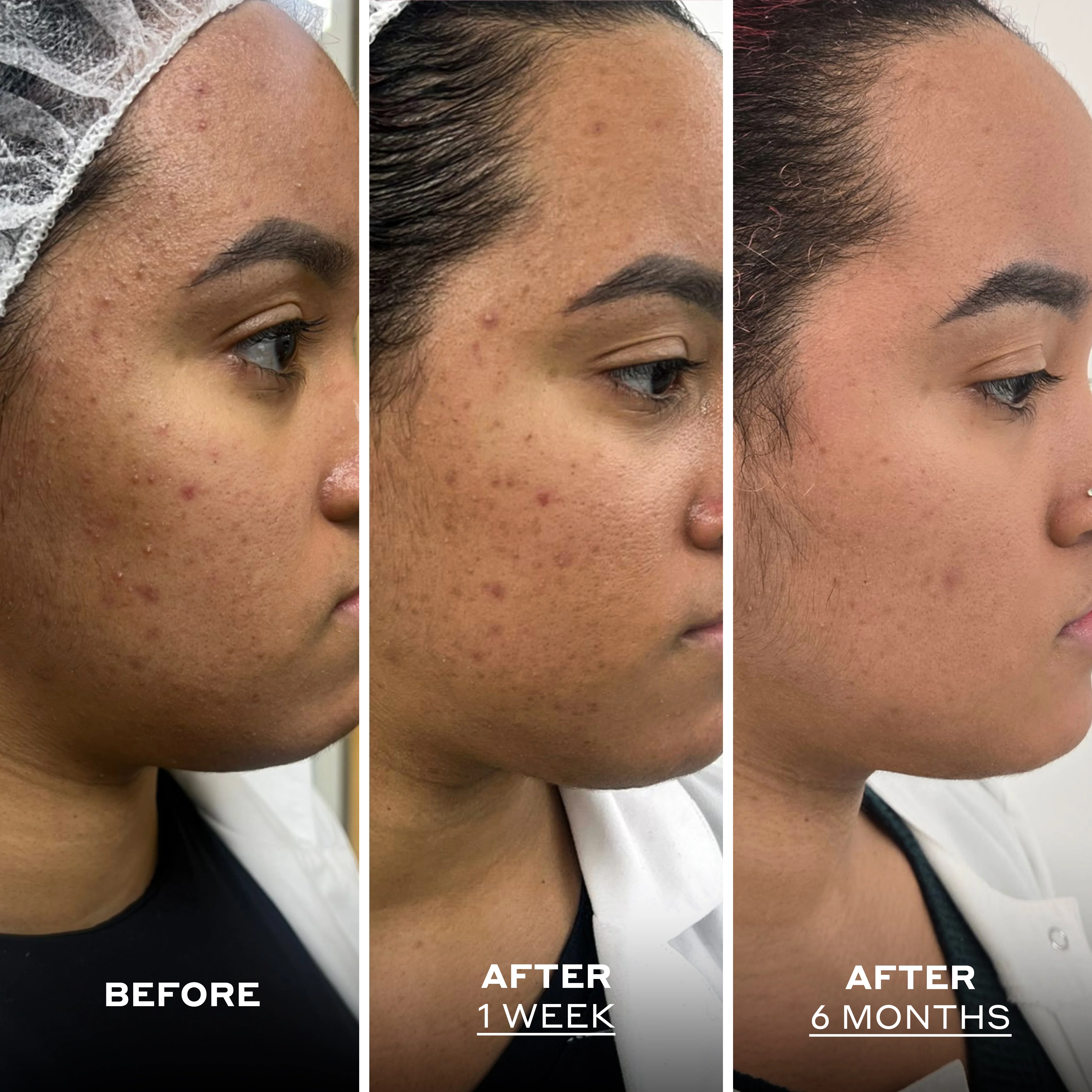 Skin Perfecting Balm with Salicylic Acid - Image 7
